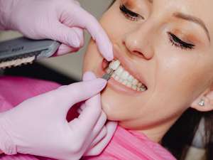 Sorriso com lentes de contato dentais de porcelana aplicadas em Brasília